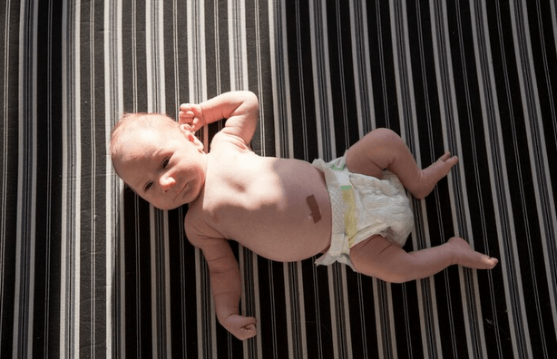 رفع زردی کودک با قرار دادن کودک در آفتاب 