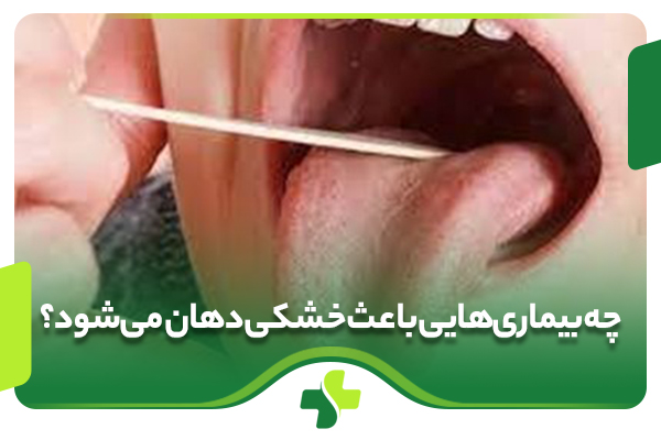 چه بیماری‌هایی باعث خشکی دهان می‌شود؟