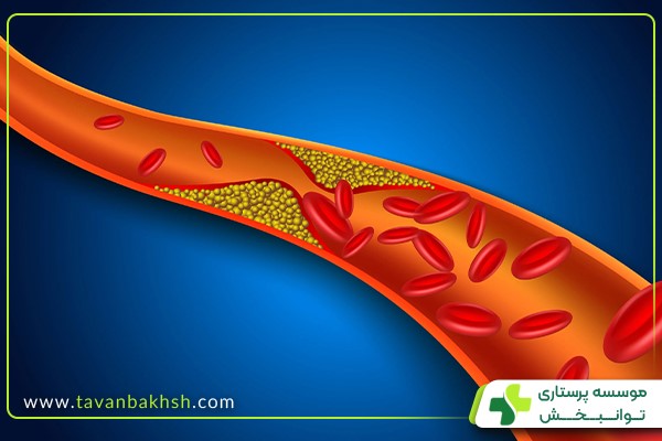 کلسترول خون بالا از عوامل خطرزای بیماری‌های قلبی در سالمندان