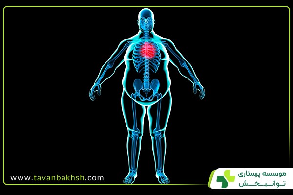 چاقی و افزایش وزن عوامل خطرزای بیماری‌های قلبی در سالمندان