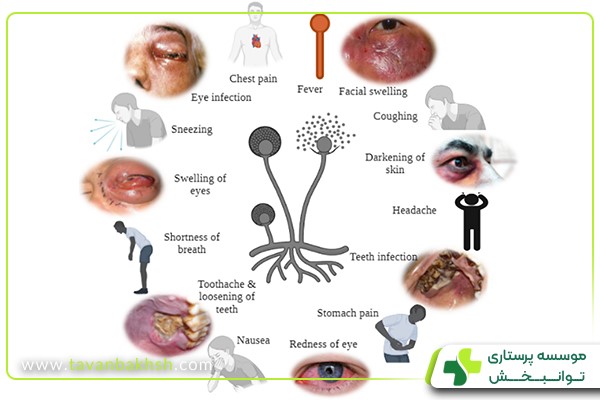 علائم خطرناک بیماری قارچ سیاه 