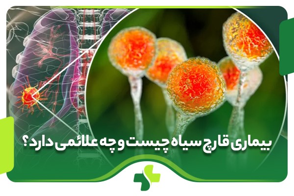 بیماری قارچ سیاه چیست و چه علائمی دارد؟