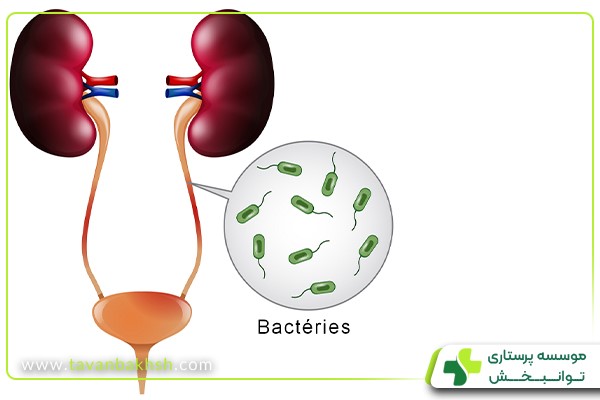 عفونت ادراری چیست؟