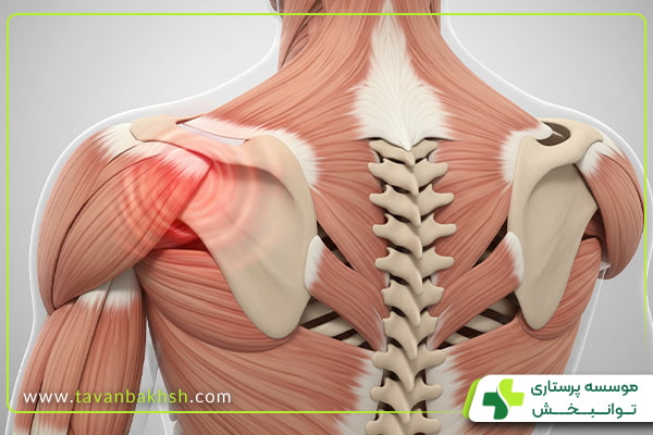 علائم همراه با درد قفسه سینه سمت چپ و پشت کتف